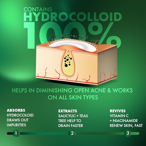Urban Yog Acne Pimple Patch - 72 Invisible Hydrocolloid Stickers for Overnight Pimple & Acne Absorption
