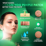 Urban Yog Acne Pimple Patch - 72 Invisible Hydrocolloid Stickers for Overnight Pimple & Acne Absorption