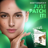 Urban Yog Acne Pimple Patch - 72 Invisible Hydrocolloid Stickers for Overnight Pimple & Acne Absorption