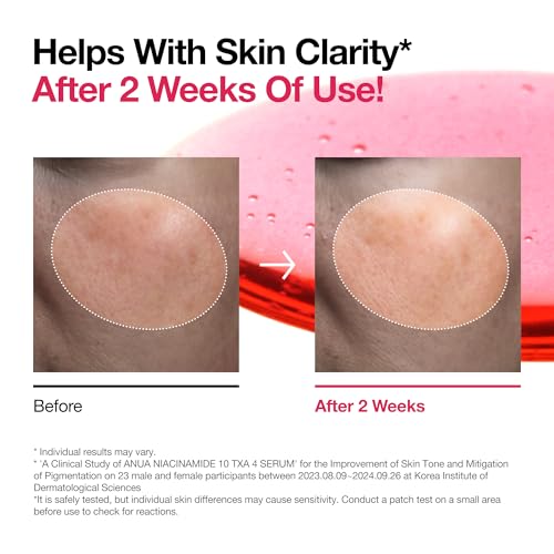 Anua 10% Niacinamide+ 4% Tranexamic Acid Serum for Sensitive Skin - Glass Skin, Fragrance-Free, 30ml
