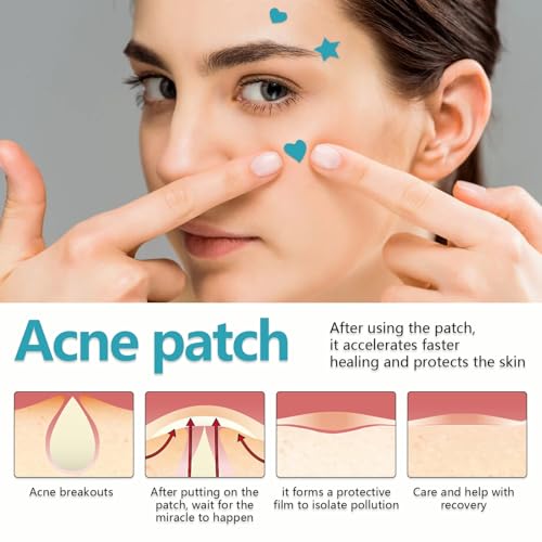 POSICHE Hydrocolloid Acne Patches 216 Pieces - Clean, Clear & Conceal Blemishes