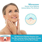 KASTWAVE Micropoint Acne Patch - 18 Patches with Advanced Anti-Acne Technology for Early Stage Blemishes