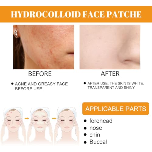 20PCS Hydrocolloid Acne Clearing Patches - Rapid Absorbing & Safe for All Skin Types
