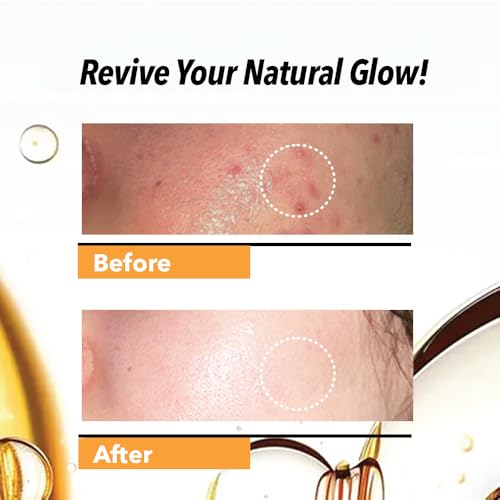 DR.Rashel Vitamin C Serum for Face | Anti-Aging & Brightening | Pore Minimizing Serum for Men & Women