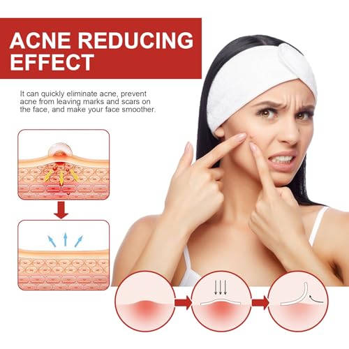 Pepisk 249-Count Multi-Shaped Hydrocolloid Acne Patches | Ultra-Thin & Invisible with Strong Adhesion for No-Makeup Looks