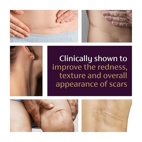 Mederma Advanced Scar Gel for Old & New Scars - Reduces Appearance