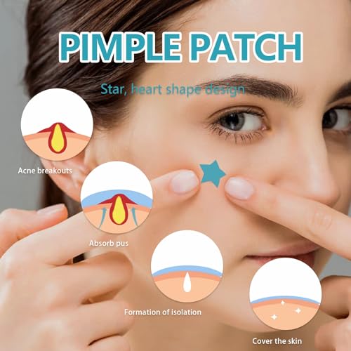 POSICHE Hydrocolloid Acne Patches 216 Pieces - Clean, Clear & Conceal Blemishes
