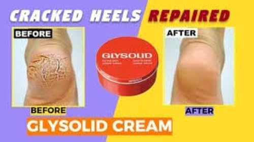 Glysolid Glycerin Cream (125ml) - Deep Moisturizing & Protective Skin Care