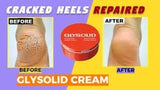 Glysolid Glycerin Cream (125ml) - Deep Moisturizing & Protective Skin Care
