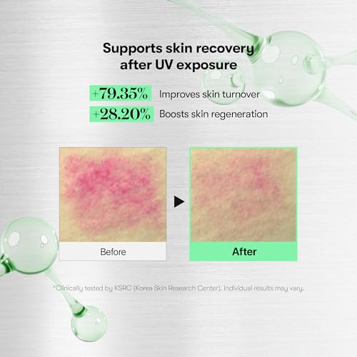 VT Reedle Shot 700 Intensive Advanced Treatment