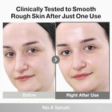 numbuzin No.4 Serum – Ceramide AHA Glazed Skin Prep Serum for Exfoliation & Barrier Repair