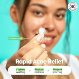 Patch Perfect Spot Patches - Korean Hydrocolloid Pimple Patches, 102 Count, Vegan & Cruelty-Free