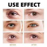 ALMEKAQUZ Retinol Intense Reactivating Eye Cream - Anti Aging, Puffiness Remover, Dark Circles, Skin Brightening