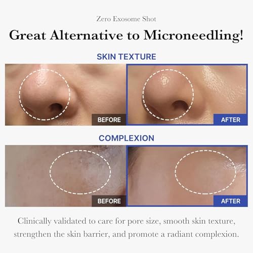 Medicube Zero Exosome Shot 2,000 PPM Facial Serum - Korean Skincare for Pores & Skin Renewal