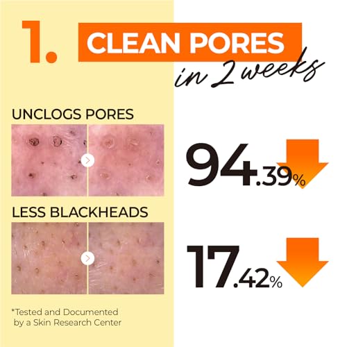 numbuzin No.1 Easy Peasy Cleansing Oil – Gentle Makeup Remover with Corn & Macadamia Seed Oils | Waterproof, Blackhead & Excess Oil Control | Hydrating, Non-Heavy | 200ml