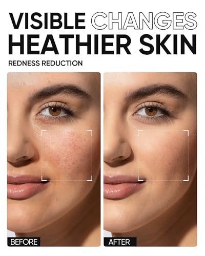 SKINTIFIC Moisturizing Cream - Hydrating Face Moisturizer with Hyaluronic Acid & 5X Ceramides - Fragrance Free, Non-Comedogenic