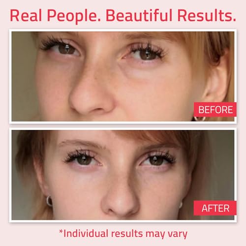 YEOUTH Retinol Eye Cream - Anti Aging, Wrinkles, Firming Eye Bags, Dark Circles