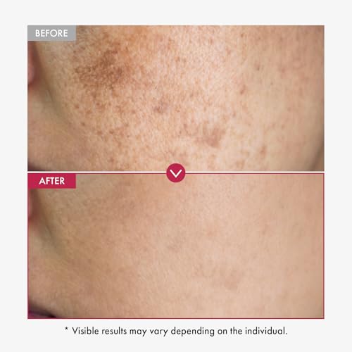 TOSOWOONG Niacinamide 10% + Tranexamic Acid 4% Serum - Korean Glass Skin Serum with Arbutin for Brightening & Radiant Complexion - 33ml