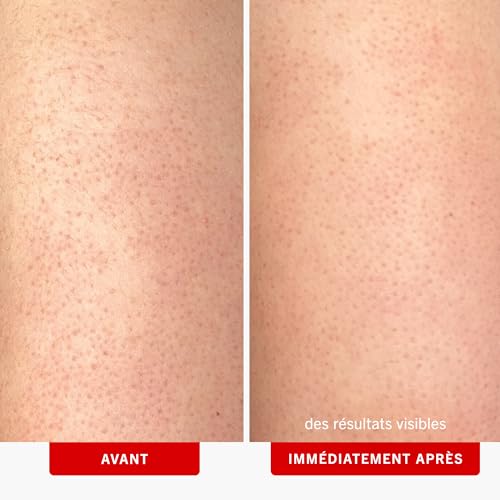 First Aid Beauty KP Bump Eraser Body Scrub - 10% AHA Exfoliant for Keratosis Pilaris (8 oz)