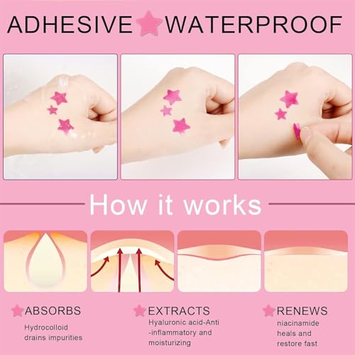X spring Acne Patch - 126 Count Star-Shaped Hydrocolloid Patches for Face & Body