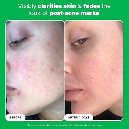Paula's Choice 10% Azelaic Acid Booster: Brighten & Smooth Skin
