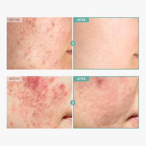 Dexpanthenol & Centella Asiatica Barrier Repair Cream | Sensitive Skin Moisturizer
