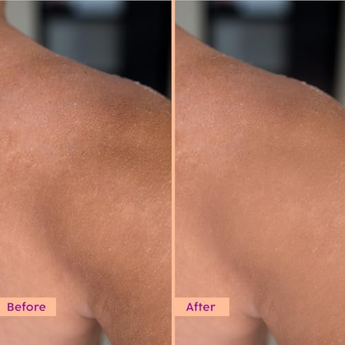 PLIX THE PLANT FIX Peaches & Lemon Body Lotion with 5% Niacinamide for Tan Reduction