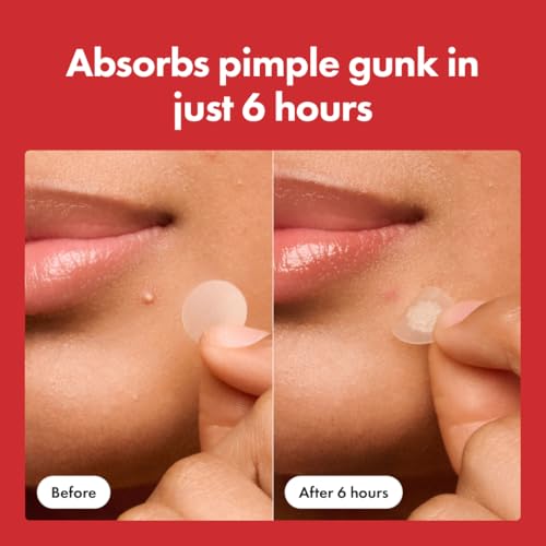 Hero Cosmetics Mighty Patch Hydrocolloid Acne Absorbing Spot Dot