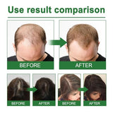 NALACAL Hair Growth Serum for Women - Natural Hair Loss Treatment & Repair