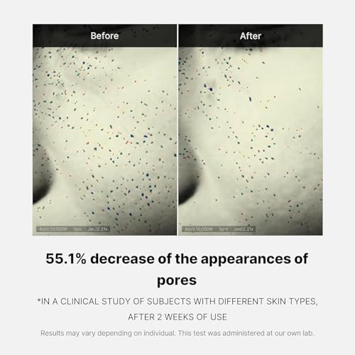 MEDICUBE Zero Pore One Day Cream 50ml - Fast-Acting Pore Refiner & Oil Controller