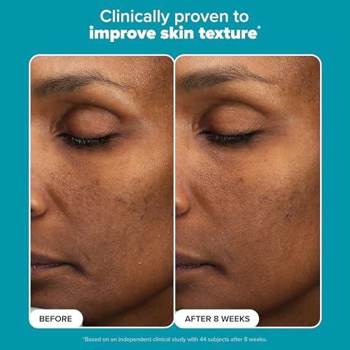 Paula's Choice 6% Mandelic Acid + 2% Lactic Acid Exfoliant - 30ml | Gentle Daily AHA Exfoliation for Sensitive Skin