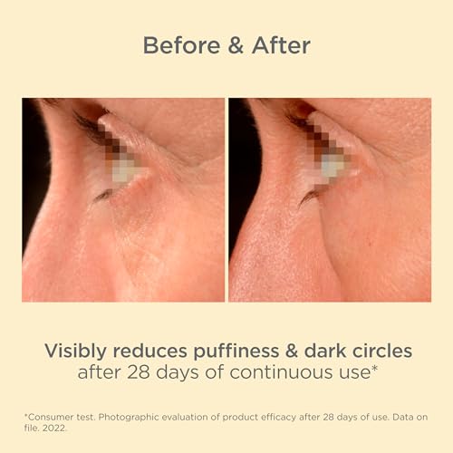 ISDIN Ceutics K-Ox Eyes Serum (15ml) - Reduce Dark Circles & Puffiness