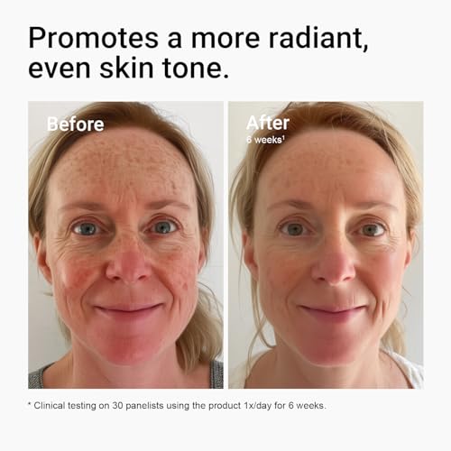 Glycolic Acid Toner 7% AHA with Aloe, Ginseng & Amino Acids - Brightening & Exfoliating Facial Toner