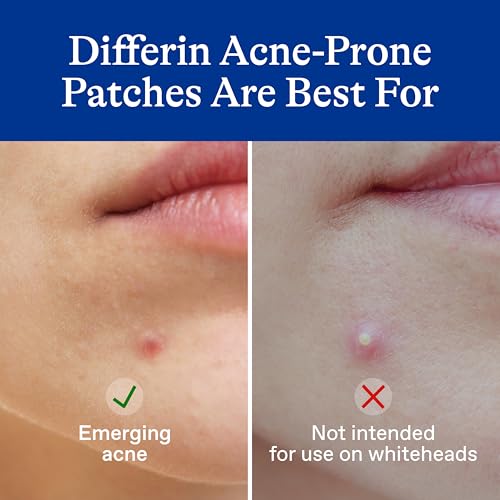Differin Acne Patches with Salicylic Acid & Centella - 36 Count