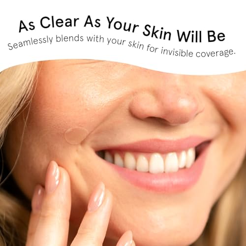 Grace & Stella Award-Winning Pore Strip - Hydrocolloid Acne Patches for Face, Invisible, 36 Count