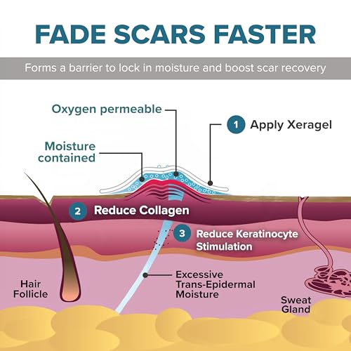 Xeragel Professional Silicone Scar Ointment - 10g Clinical Formula