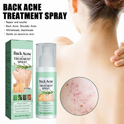 ERIKO 2% Salicylic Acid Back Acne Spray, Tea Tree Oil + Body Acne Spray with 2% Salicylic Acid, Teen acne treatment