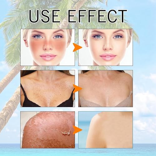2PCS Mati rich Sunscreen Gel, Broad Spectrum Face & Sun cream in Shining Essence Sunglass Types