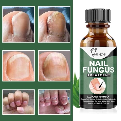 WINDALY® Premium Anti-Fungus Nail Treatment Oil for Toenails (50ml)