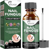 WINDALY® Premium Anti-Fungus Nail Treatment Oil for Toenails (50ml)