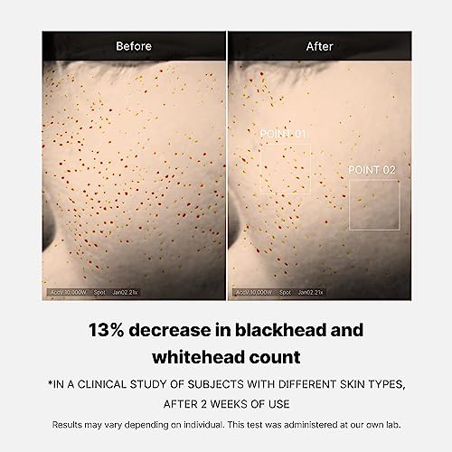 Medicube Zero Pore One Day Serum - 30ml | Korean Skincare for Pore Minimizing