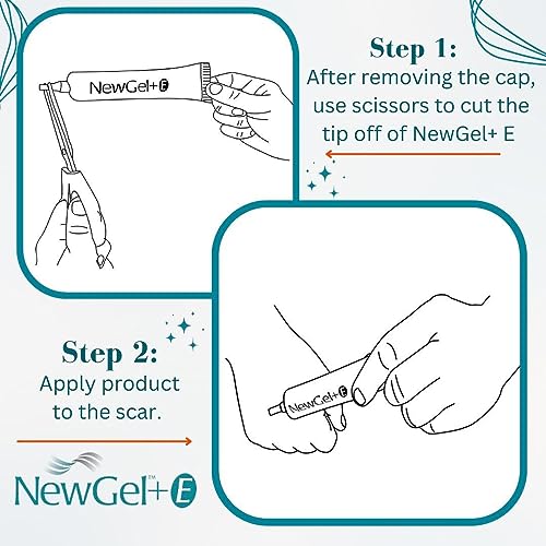 NewGel+E Advanced Scar Treatment Gel with Vitamin E - 30ml