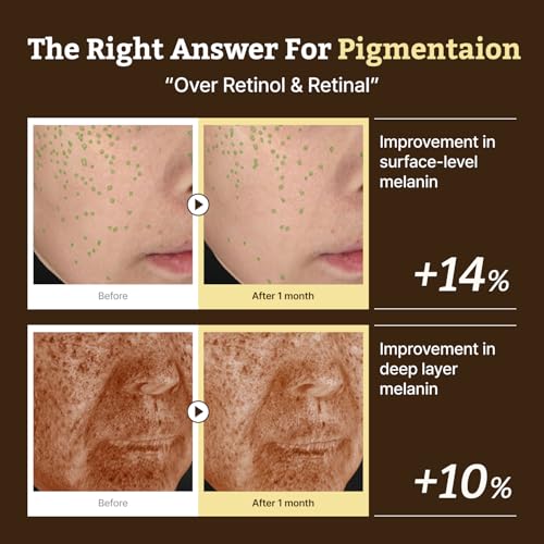Dr.Reju-All Advanced Retino-Mela Serum | HPR Retinol Serum for Face | Anti-Aging, Pore Minimizer, Next-Gen Korean Skincare | Gentle & Beginner-Friendly | With Niacinamide 10% and TXA 4% – 1 Fl Oz