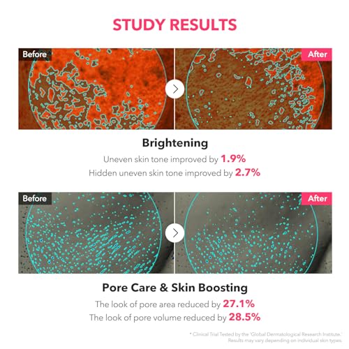 APRILSKIN TXA Niacinamide Toning Shot 99 Spicule Serum – 3% Tranexamic Acid + 5% Niacinamide 30mL