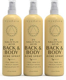 Acne Treatment Body Spray with Salicylic Acid for Back & Chest Acne, 3 Pack, Hormonal & Bacne Relief for Teens & Adults