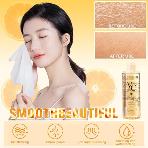 Mhepzol VC Toner - 300ml Vitamin C Moisturizing Toner for Skin Brightening and Hydration