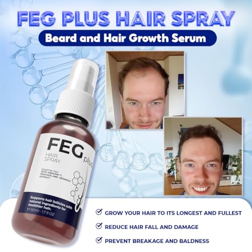 Rosemary Beard & Hair Serum with Minoxidil 5% - Hair Growth Treatment for Men