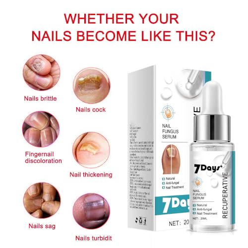 Nail Fungus Treatment Essence - Fungal Nail Repair for Toes & Ingrown Nails (20ml)