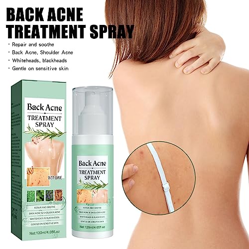 ERIKO 2% Salicylic Acid Back Acne Spray, Tea Tree Oil + Body Acne Spray with 2% Salicylic Acid, Teen acne treatment