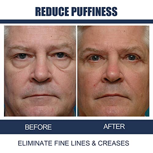 Retinol Under Eye Cream for Dark Circles, Puffy Eyes & Fine Lines - Fade Wrinkles & Improved Skin Texture